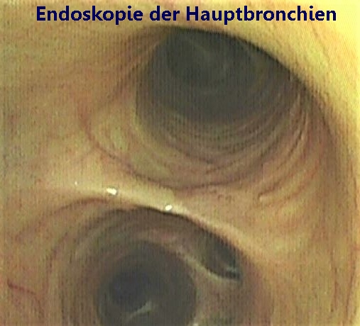b-Hauptbronchien